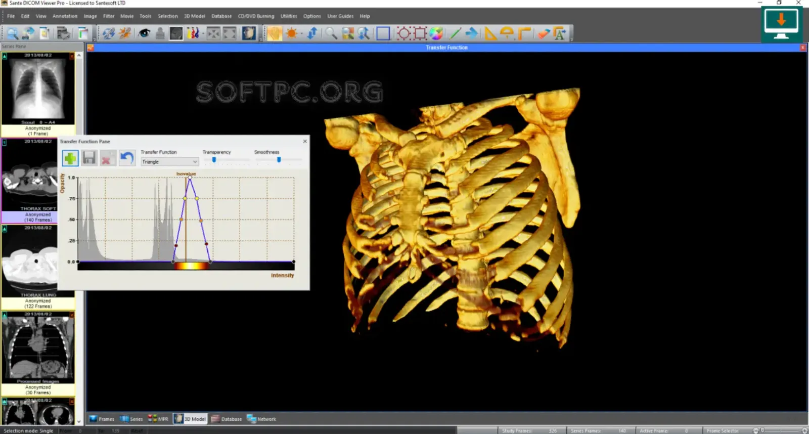 Sante DICOM Viewer Pro com MPR e visualização 3D