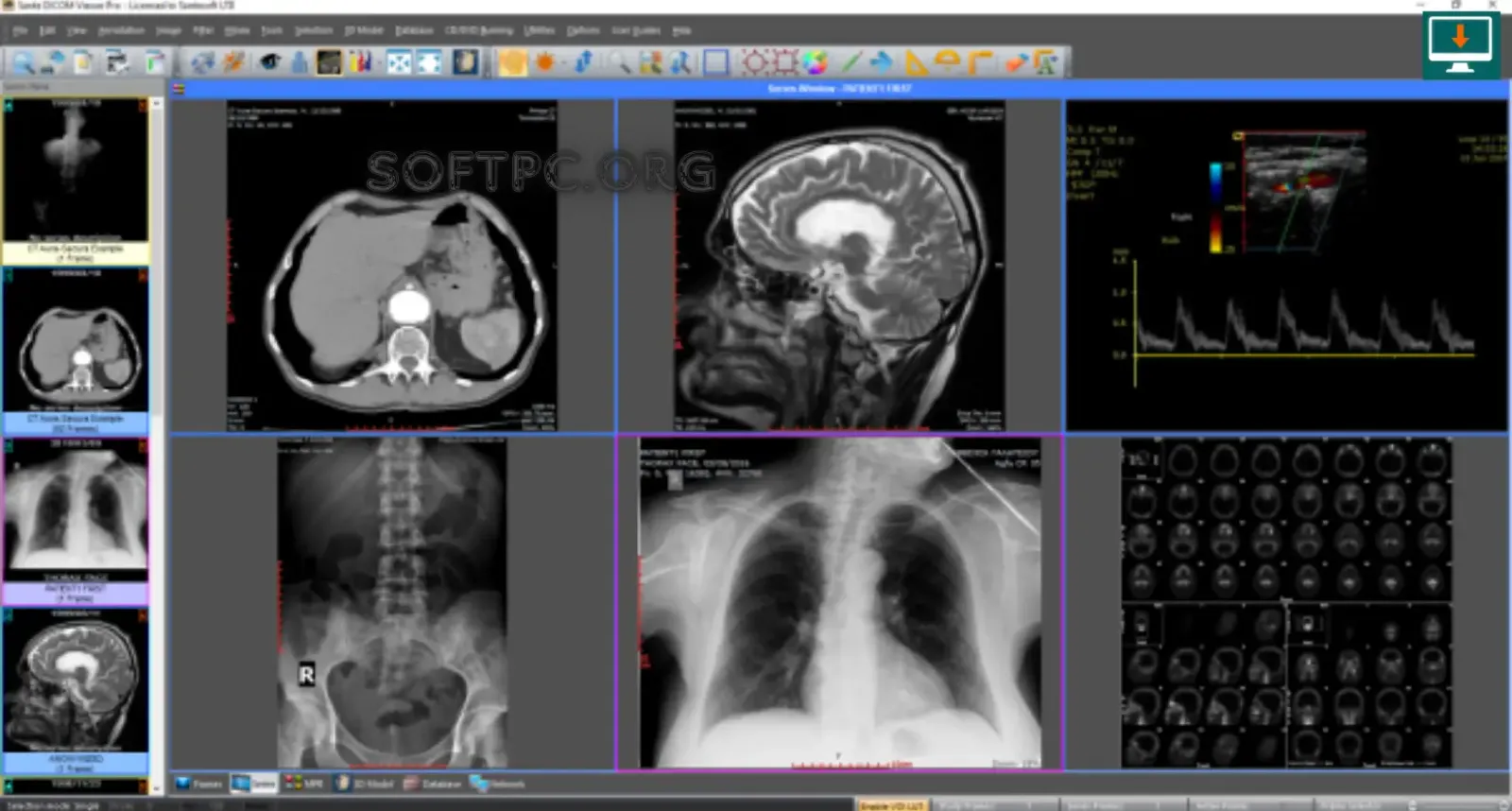 Sante DICOM Viewer Pro para visualizar arquivos DICOM em 2D e 3D